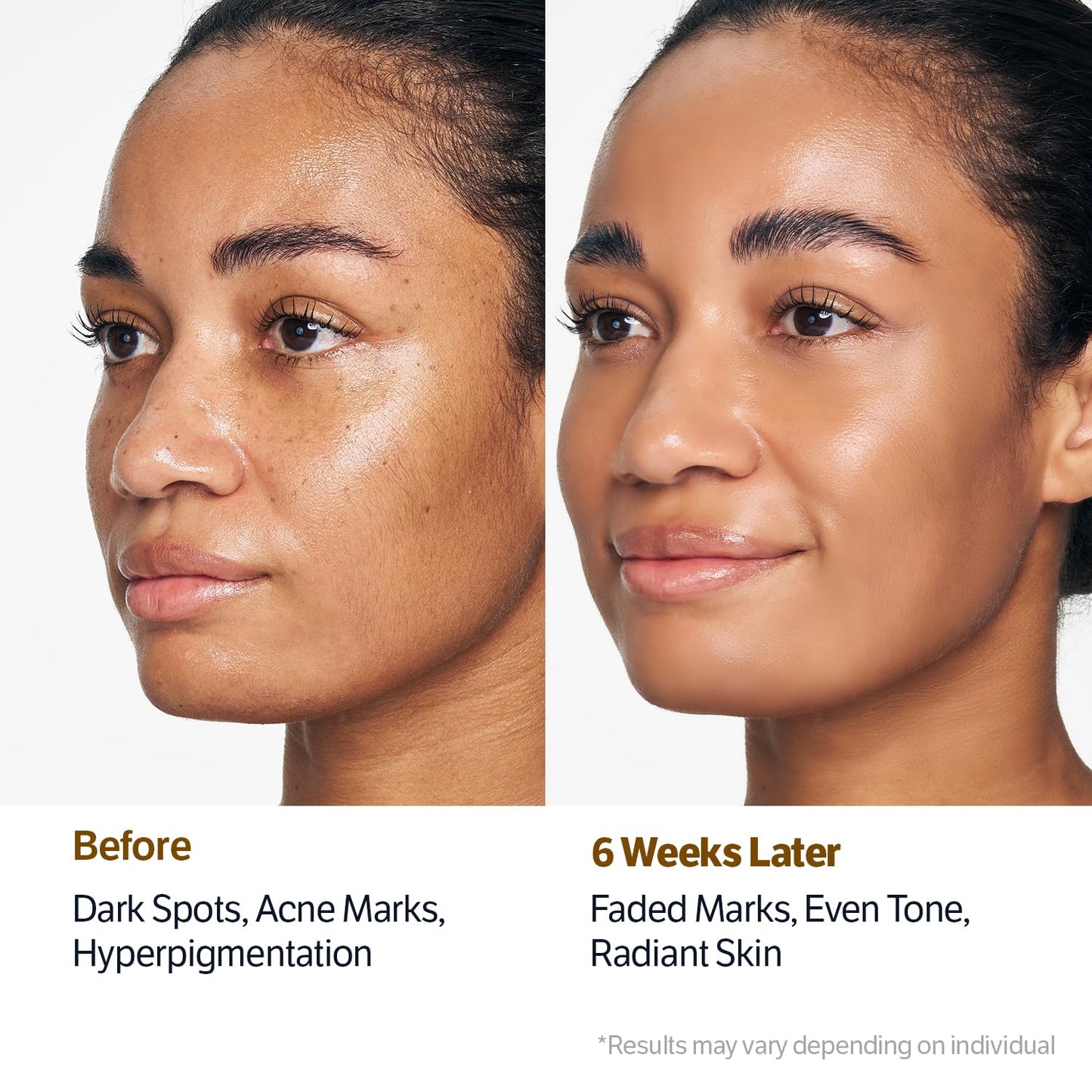 💖Last 3 Hours 50% OFF  ✨ BUY 2 GET 2 FREE🔥SONGBOON Editor Glass Skin Collagen Volufiline Cream-in-Serum | Gentle, Nourishing &Comfort Korean Skincare Moisturizer for Firming & Hydrating