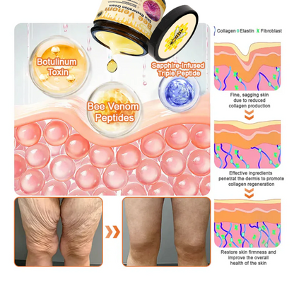 🔥Limited Time 80% OFF🔥LOVILDS® Bee venom Pro Comprehensive Cream