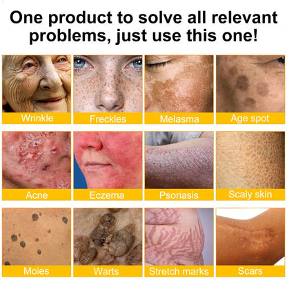 🔥Limited Time 80% OFF🔥LOVILDS® Bee venom Pro Comprehensive Cream