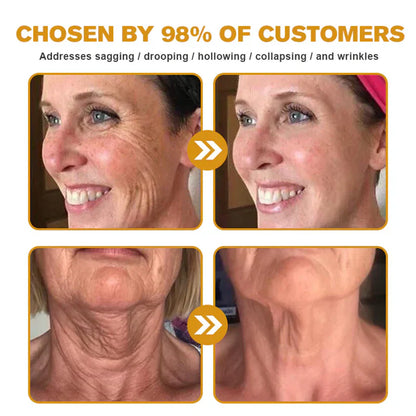 🔥Limited Time 80% OFF🔥LOVILDS® Bee venom Pro Comprehensive Cream