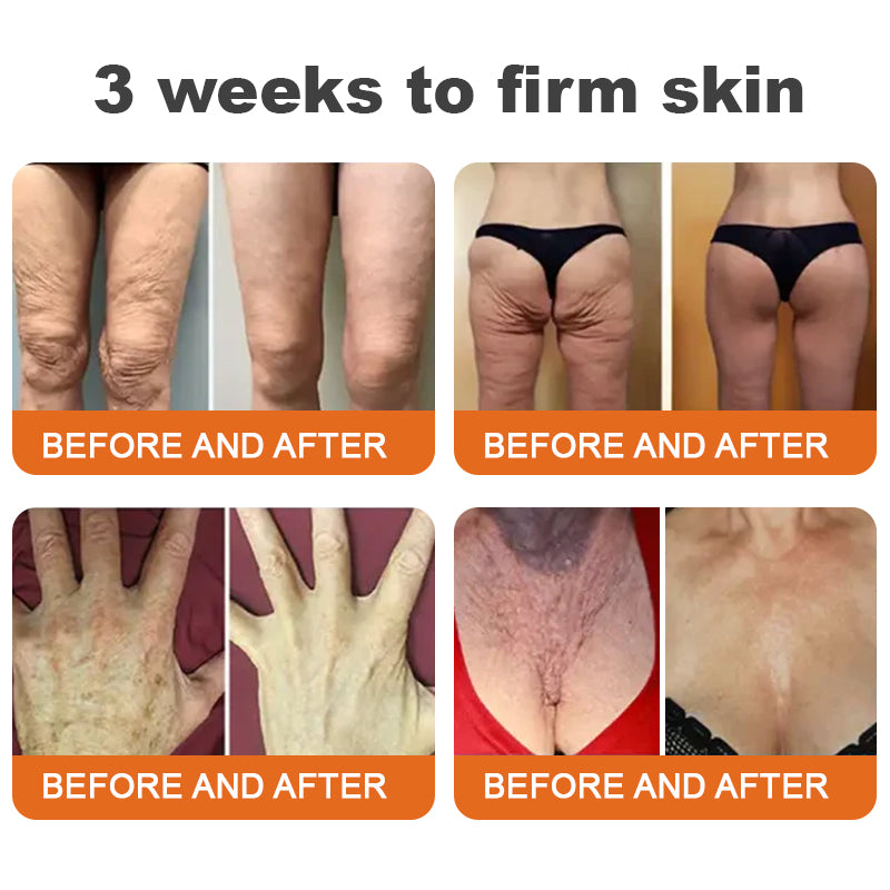 🍇Flysmus™ Botox Bee Venom Firming Serum Stick LAST DAY 70% OFF