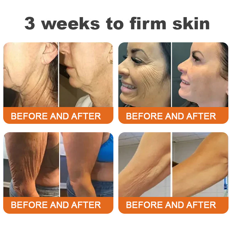 🍇Flysmus™ Botox Bee Venom Firming Serum Stick LAST DAY 70% OFF