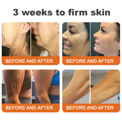 🔥Limited Time 80% OFF🔥LOVILDS® Bee venom Pro Comprehensive Cream