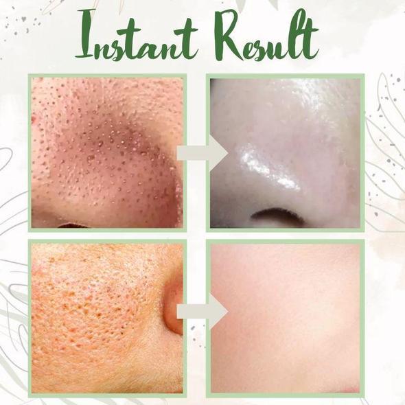 🔥LAST DAY SALE-80% OFF)Final Sale -Insideefy Holy Basil Bubble Deep Mask 13%