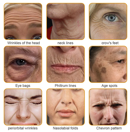 🍈Furzero™ Botox Bee Venom Wrinkle Removal Cream-Last Day Promotion 70% OFF