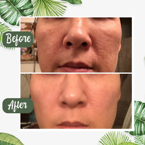 🔥LAST DAY SALE-80% OFF)Final Sale -Insideefy Holy Basil Bubble Deep Mask 13%