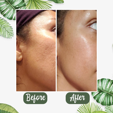 🔥LAST DAY SALE-80% OFF)Final Sale -Insideefy Holy Basil Bubble Deep Mask 13%