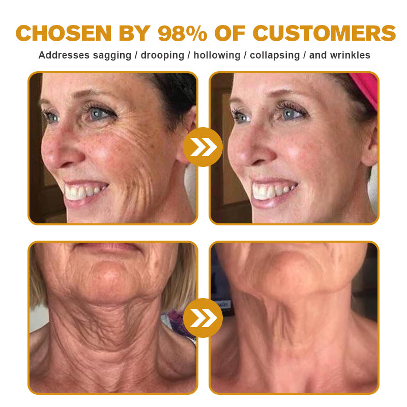 🍈Furzero™ Botox Bee Venom Wrinkle Removal Cream-Last Day Promotion 70% OFF