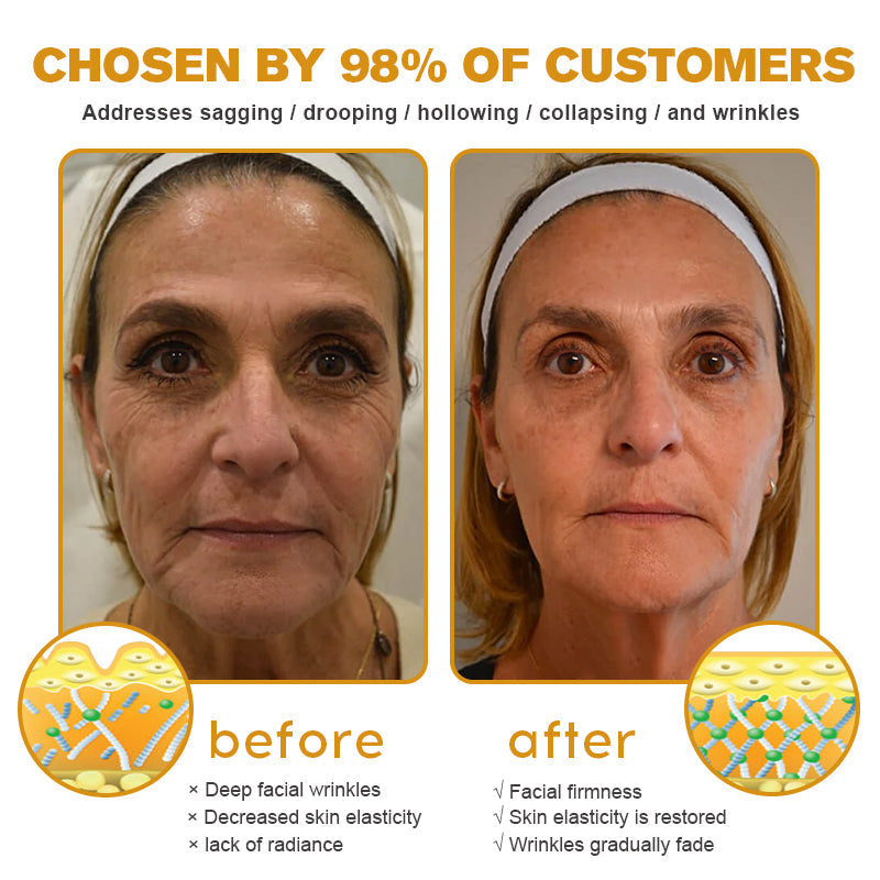 🍈Furzero™ Botox Bee Venom Wrinkle Removal Cream-Last Day Promotion 70% OFF