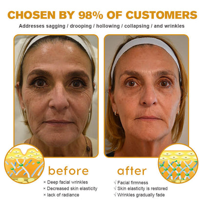 🍈Furzero™ Botox Bee Venom Wrinkle Removal Cream-Last Day Promotion 70% OFF